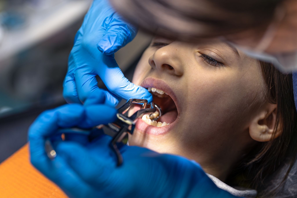 Dental Implants