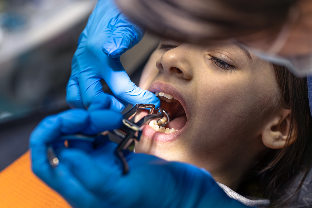 Why Dental Implants Are the Best Solution for Missing Teeth 