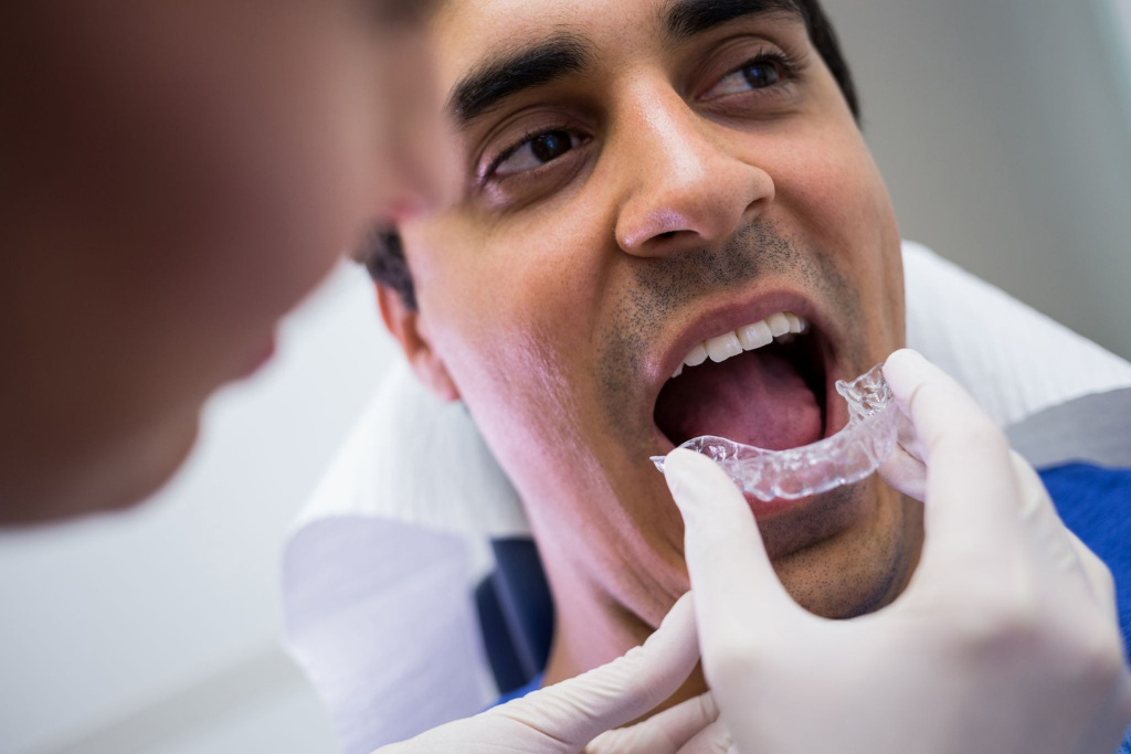 Dental Aligners