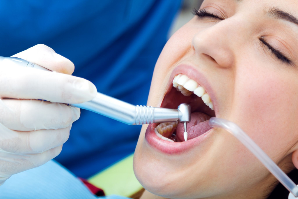 A Complete Guide to Choosing a Dentist for Root Canal Treatment